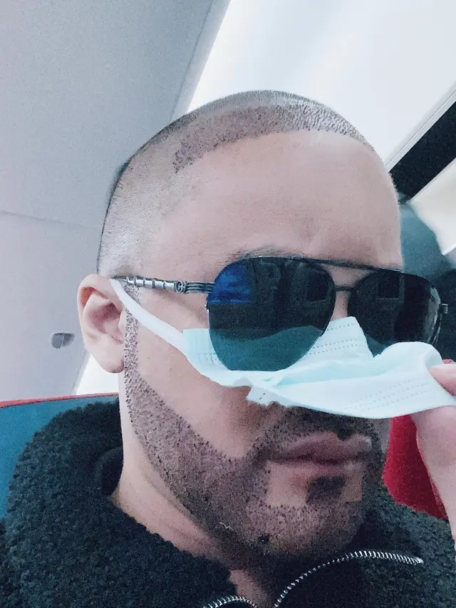 5 Potret Terbaru Kevin Aprilio Usai Transplantasi Rambut, Bikin Pangling