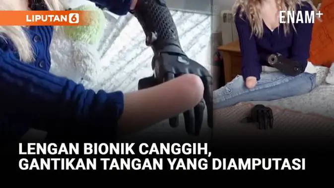 Lengan Bionik Canggih, Bisa Gantikan Tangan yang Diamputasi!