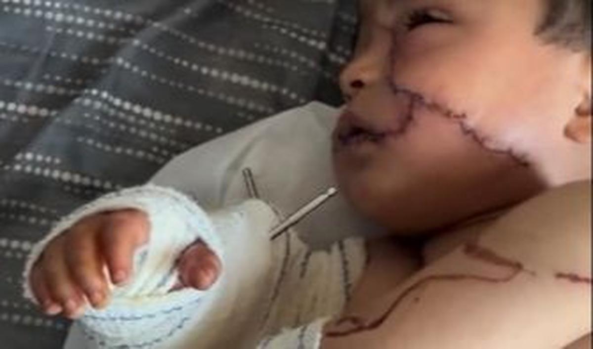 "Anak kecil Sanad Alarabi terluka parah akibat pemboman Israel di Gaza," tulis keterangan unggahan.