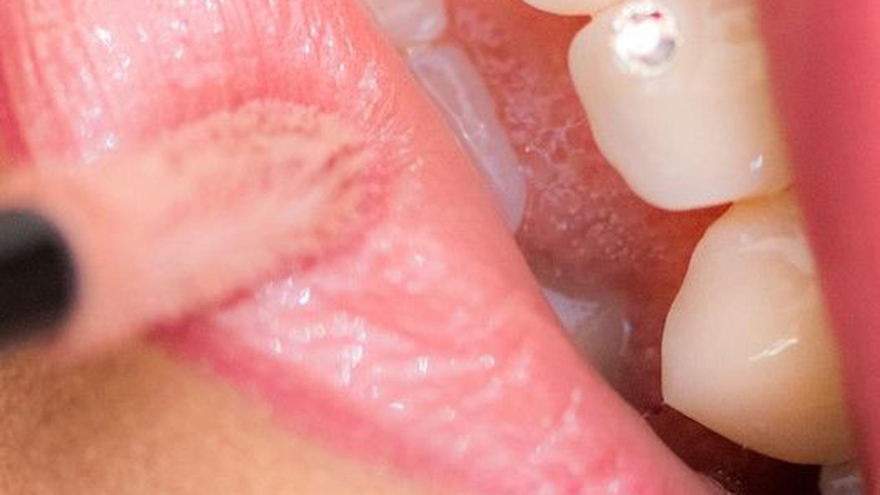 Viral Wanita Lakukan Sulam Bibir Demi Hemat Lipstik, Hasilnya di Luar Dugaan
