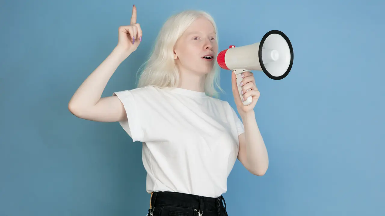 perempuan albino
