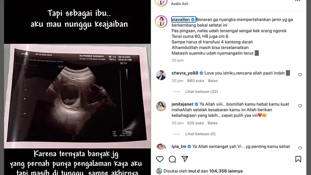 Unggahan Via Vallen. (Foto: Dok. Instagram @viavallen)
