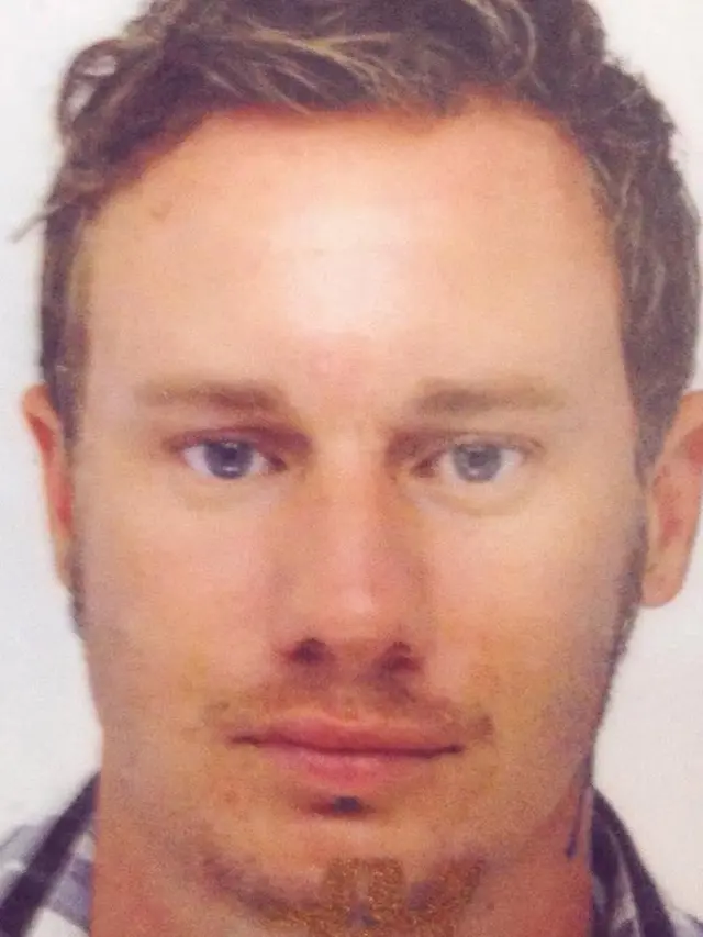 [Bintang] Sebelum Suntik Botox Cowok Ini Ganteng, tapi Sekarang Wajahnya...