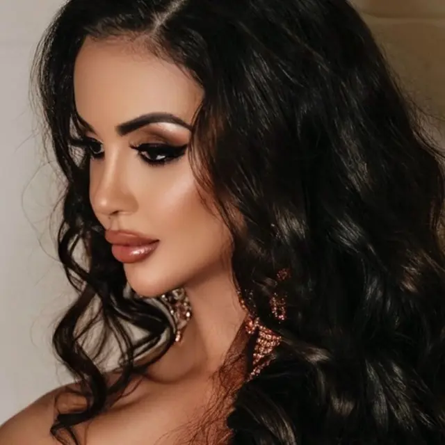 Habis Rp8,9 Miliar untuk Operasi Plastik, Kim Kardashian KW Rogoh Rp1,8 Miliar agar Kembali ke Wajah Asli