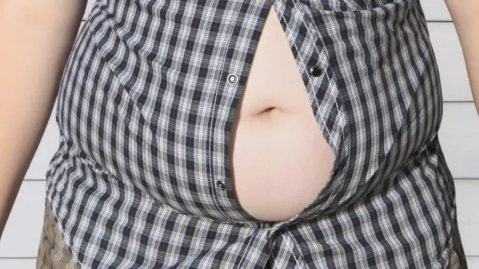 Dua Gangguan pada Penis Anak Gemuk yang Sulit Disunat
