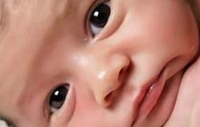Penyebab Pneumonia pada Bayi, Ketahui Gejala dan Cara Mencegahnya