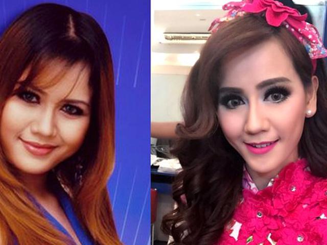 Nita Thalia Operasi Plastik Seharga Rp 1 Miliar Showbiz Liputan6 Com