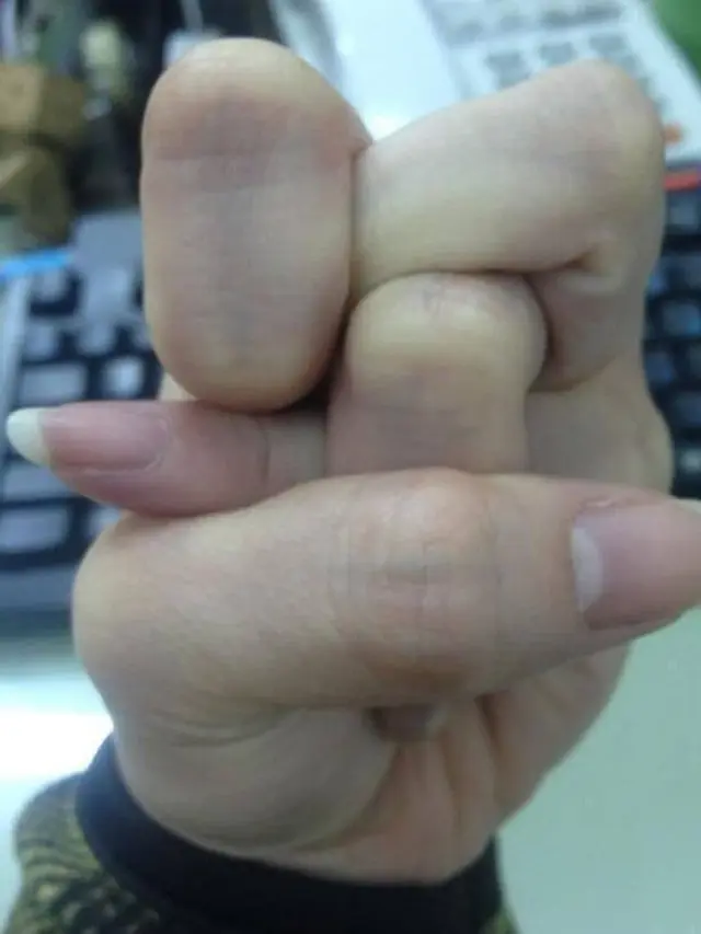 6 Aksi Nyeleneh Orang Kalau Punya Tangan Lentur Ini Bikin Heran