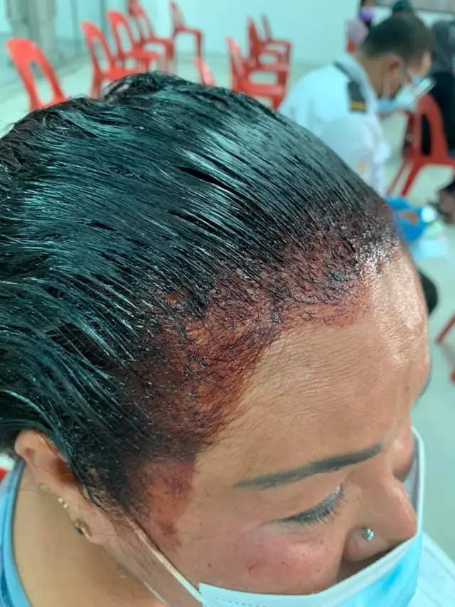 Tak Ingin Ketinggalan Vaksin, Aksi Kocak Wanita Ini Antre saat Rambut Sedang Dicat