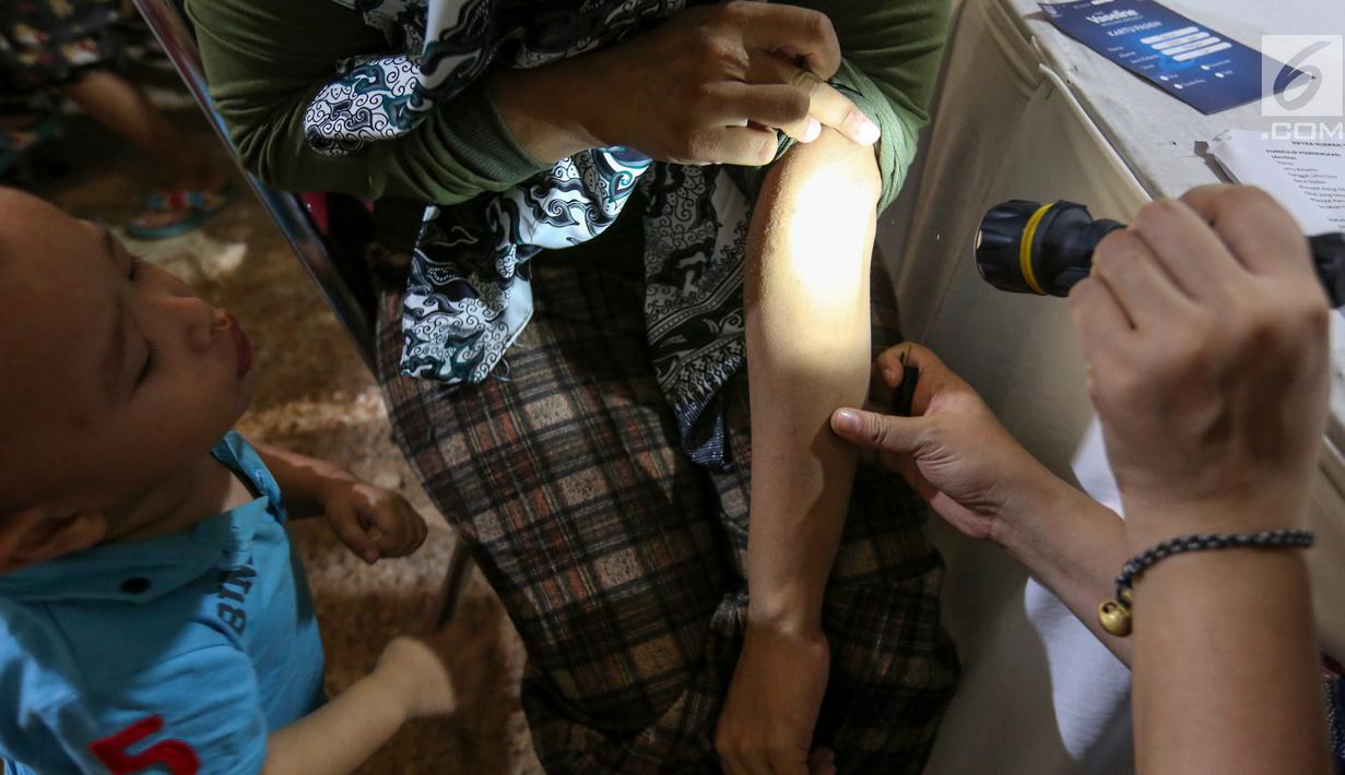 Warga sedang diperiksa kulit bagian tangan di komplek Rusunawa Muara Baru, Jakarta, Selasa (14/5/2019). Setiap warga berkesempatan untuk berkonsultasi dan mendapatkan pelayanan dari para dokter spesialis kulit yang tergabung dalam PERDOSKI terkait dengan gangguan kulit. (Liputan6.com/Fery Pradolo)