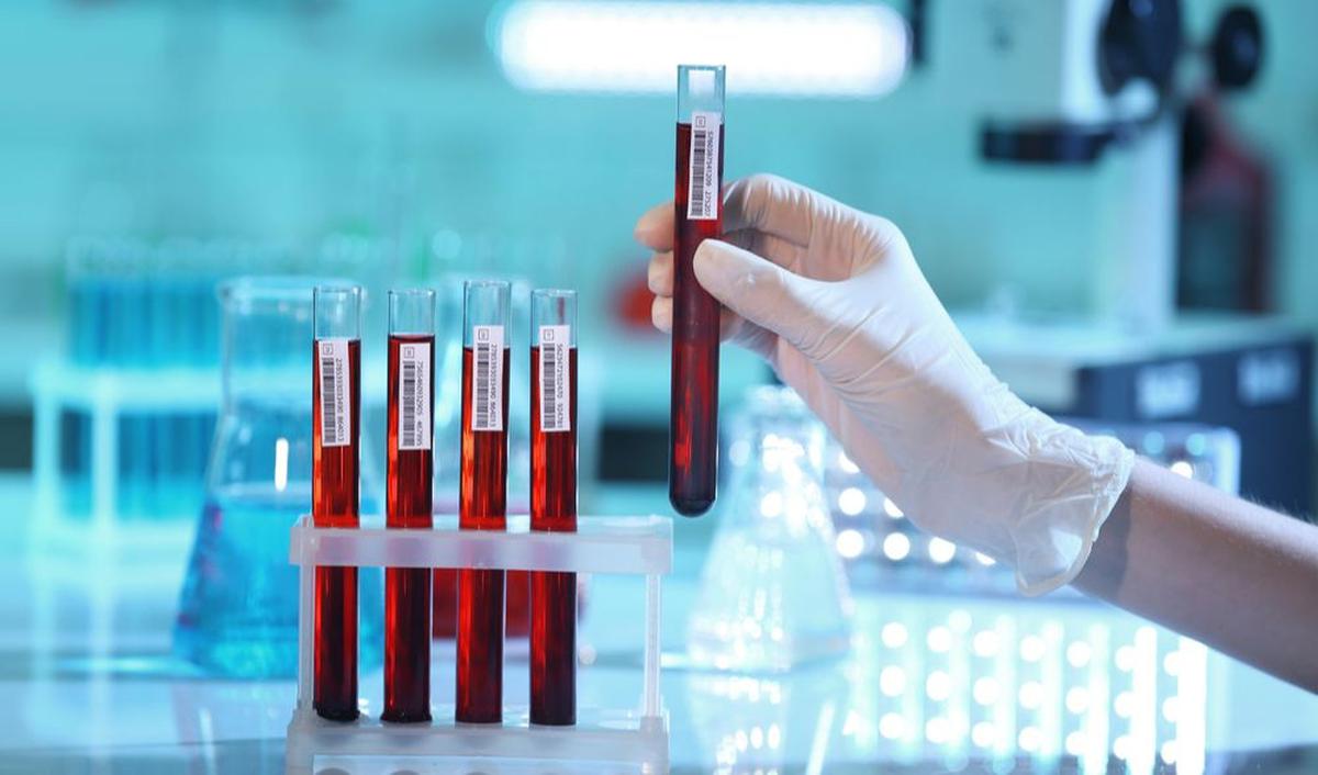 Mengenal Polycythemia Vera, Penyakit yang Menimpa Sri Suharyati<br>