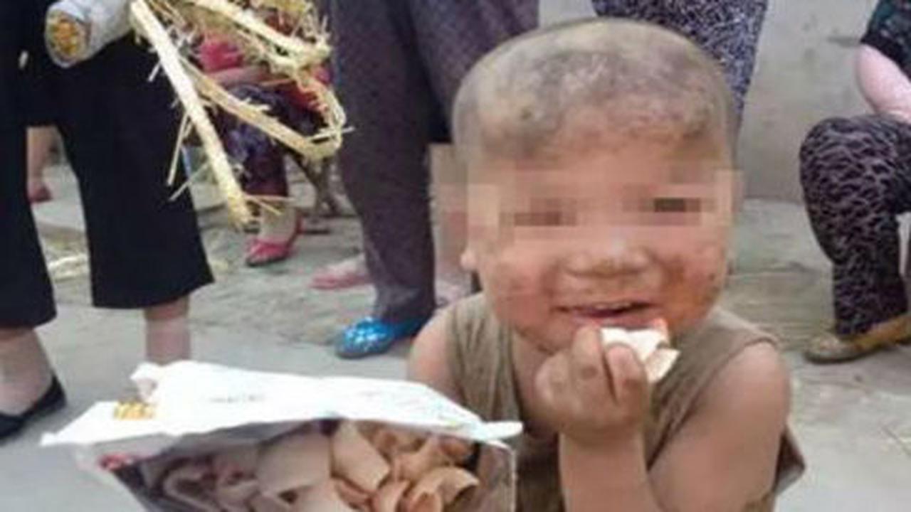 Bikin pilu, lima bocah ini menderita disiksa orangtua