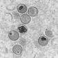 Tangkapan mikroskop elektron bagian ultratipis dari virus cacar monyet file 2004. (Gambar: AFP/RKI Institut Robert Koch/Freya Kaulbars)