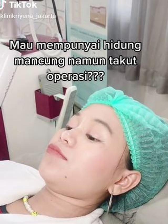 6 Potret Terbaru Cimoy Nuraini Usai Filler Hidung, Tampil Beda