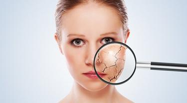 Kulit Wajah Kering Dan Bersisik Atasi Dengan Tips Ini Ladies Beauty Fimela Com