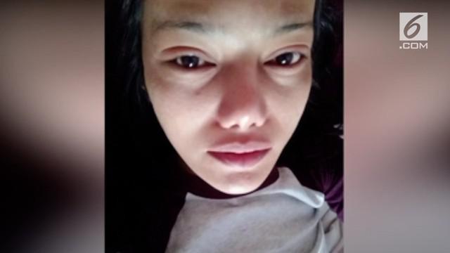 Wanita bernama Benyapa Supap mengalami iritasi pada kedua matanya setelah melakukan metode pemanjangan bulu mata. Diduga bahwa bulu mata palsu ditempel dengan lem super.