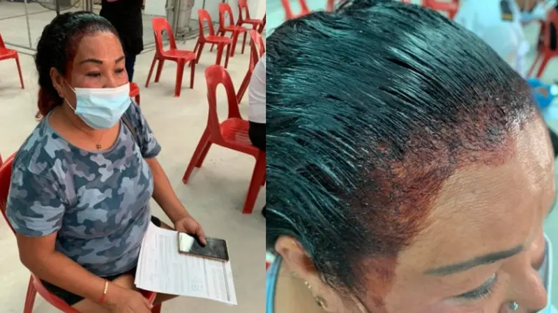 Bikin Ngakak, Ibu Ini Buru-Buru ke Tempat Vaksinasi Covid dengan Rambut Baru Dicat Separuh