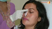 Cus, cus, Hidung Lebih Indah Alami dengan Suntik Filler Restylane