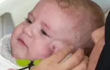 Perbedaan Baby Blues vs Postpartum Depression Menurut Para Ahli, Parah yang Mana?
