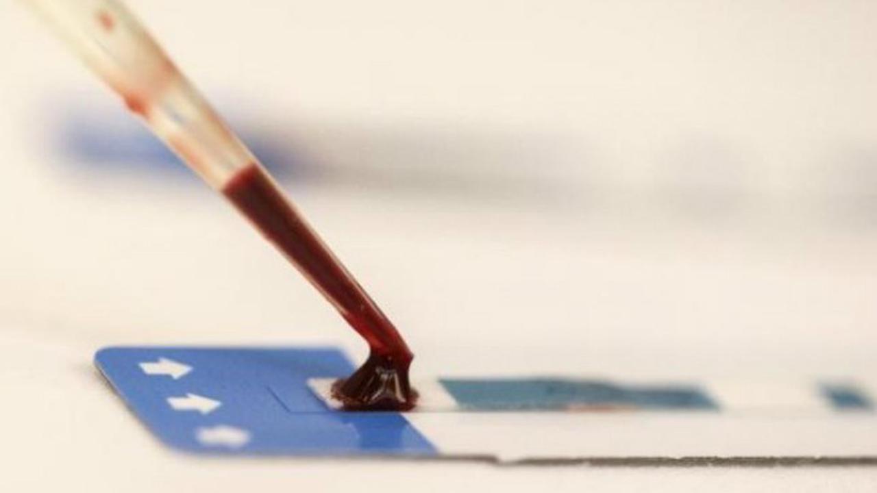 7 Tahun Menunggu Mati, Pria Ini Ternyata Salah Didiagnosis HIV