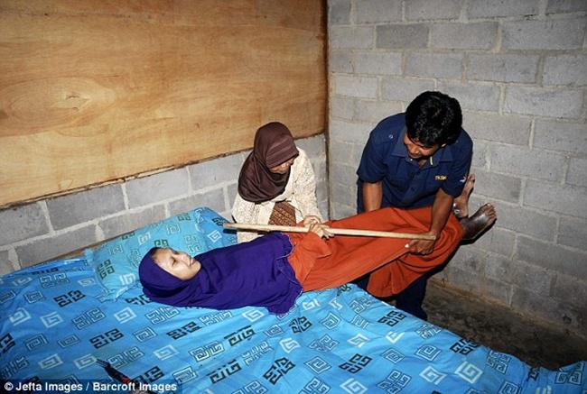 Sulami, wanita yang memiliki tubuh kaku seperti papan kayu asal Sragen | Photo: Copyright dailymail.co.uk