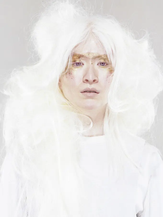 [Fimela] Connie Chiu, model albino yang mengubah perbedaan jadi kelebihan