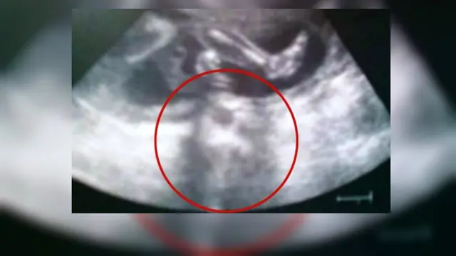 Ada penampakan Yesus di dalam foto USG ini?