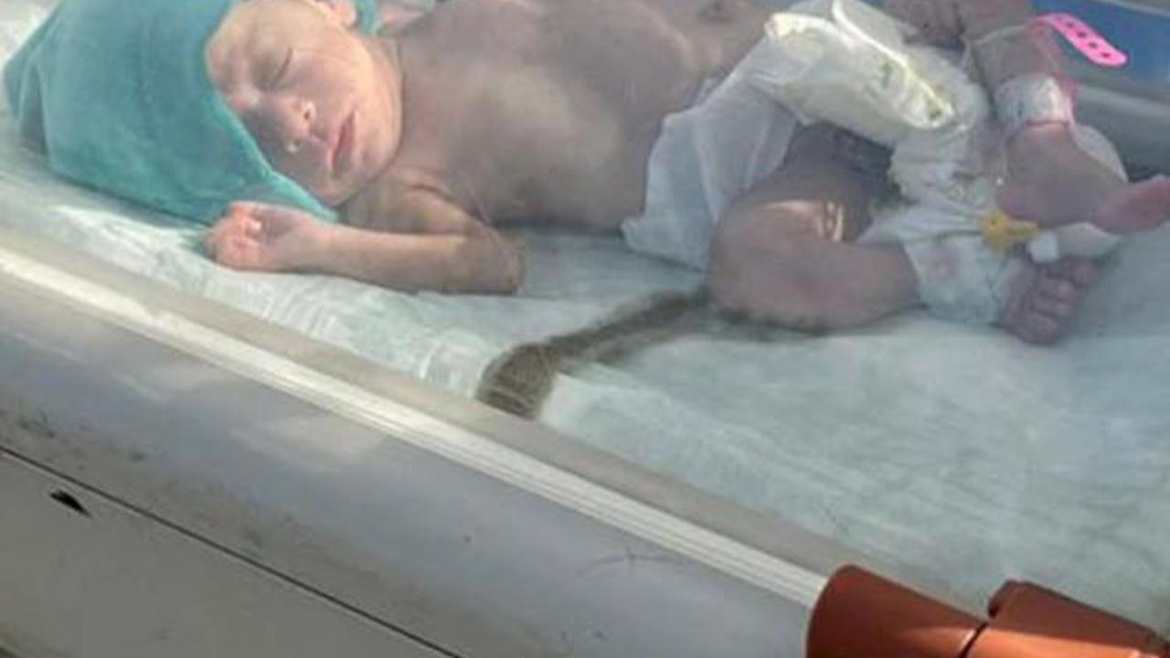 FOTO: Potret Puluhan Bayi Prematur Tanpa Orang Tua Dievakuasi dari RS Al-Shifa Gaza ke Mesir