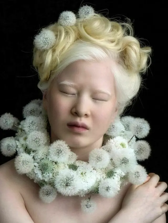 Dibuang ke Panti Asuhan Karena Albino, Ini 6 Potret Xueli Kini Sukses Jadi Model. (Sumber: Instagram/xueli_a)