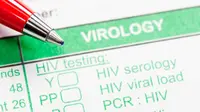 Kementerian Kesehatan mengungkapkan setidaknya ada 26 Rumah Sakit yang bisa menjadi rujukan dan memiliki alat tes HIV