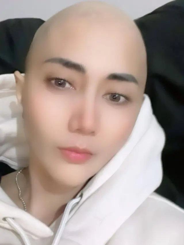 Aida Saskia Jalani Kemoterapi