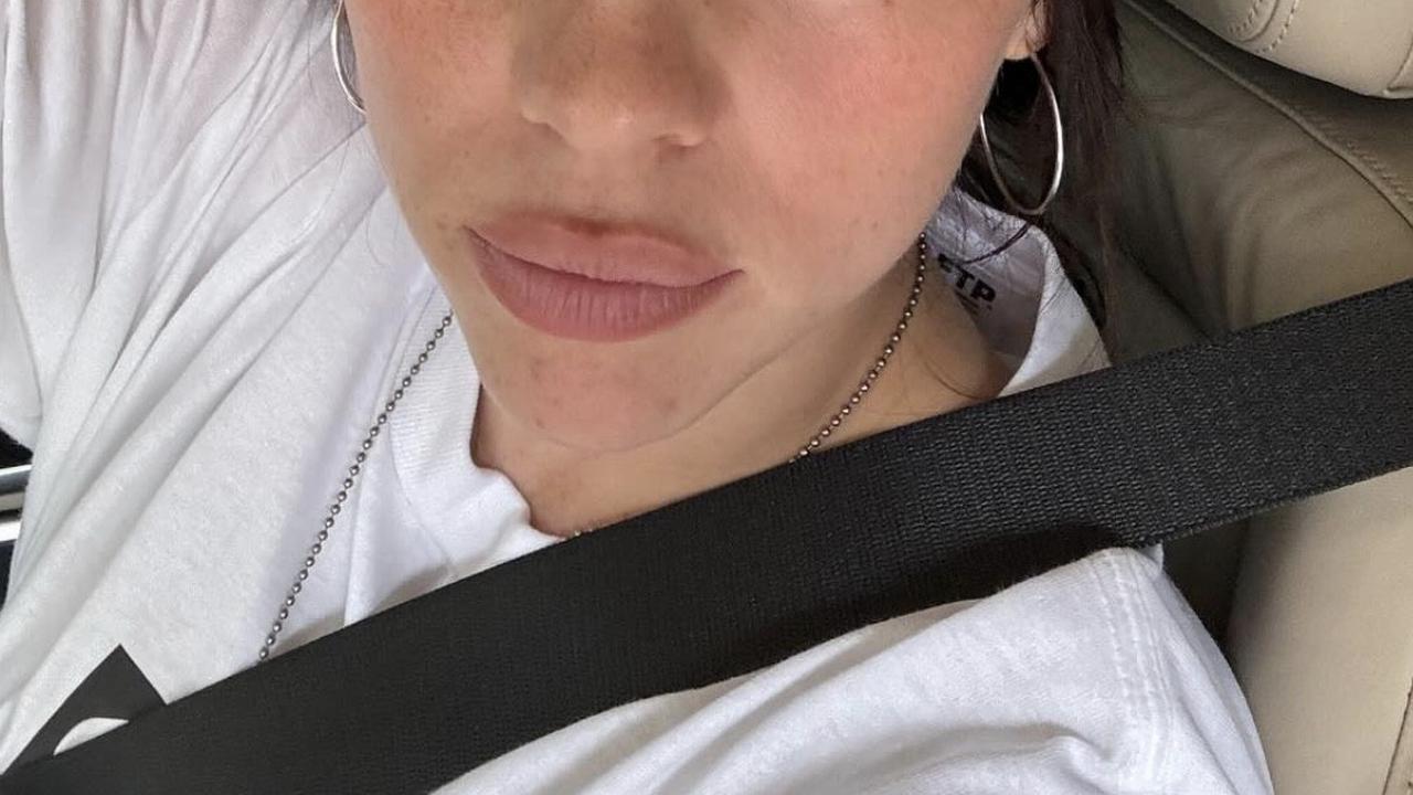Billie Eilish Ogah Bahas Kehidupan Asmaranya Lagi, Ini Alasannya!