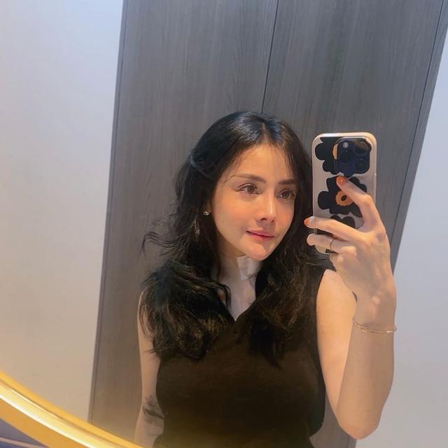 Habiskan Rp 521 Juta Untuk Oplas, Ini 6 Potret Terbaru Mawar AFI Bikin Pangling