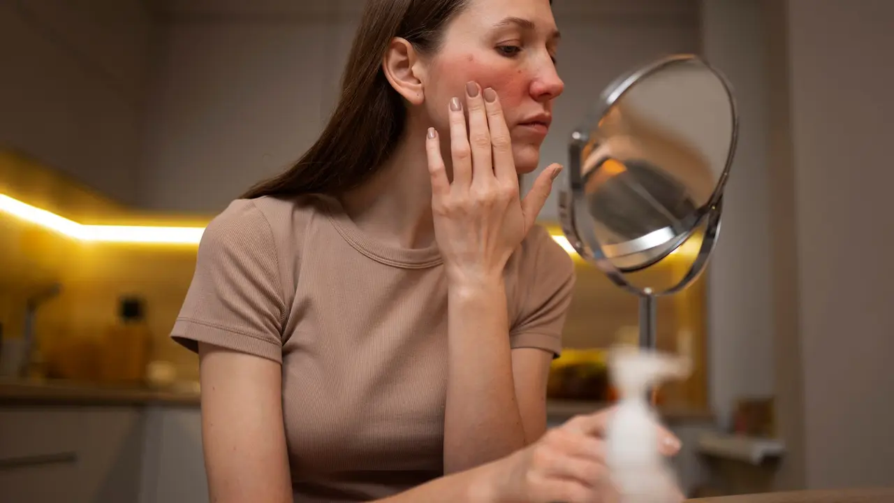 Kulit Mudah Breakout saat Cuaca Berubah? Kenali Tips Skincare Adaptasi agar Tetap Seimbang dan Glowing
