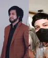 Belakangan ini transplantasi rambut menjadi tren di kalangan selebriti Tanah Air. Mulai dari Kevin Aprilio hingga Atta Halilintar, berikut potret transformasinya.