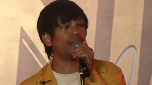 Nampak mata sebelah kiri Rian D'Masiv memar Saat Manggung di Banyuwangi  akibat kecelakaan tunggal di Jalan Raya  Asembagus Situbondo (Hermawan Arifianto/Liputan6.com)