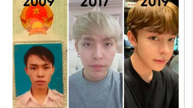 Ditolak Kerja karena Kurang Ganteng, Pria Nekat Operasi Plastik hingga Mirip Idol Kpop