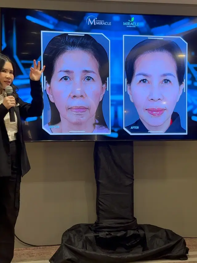 Facial Harmony 2.0 dari Miracle Aesthetic Clinic untuk lebih awet muda. [Anisha/Fimela]