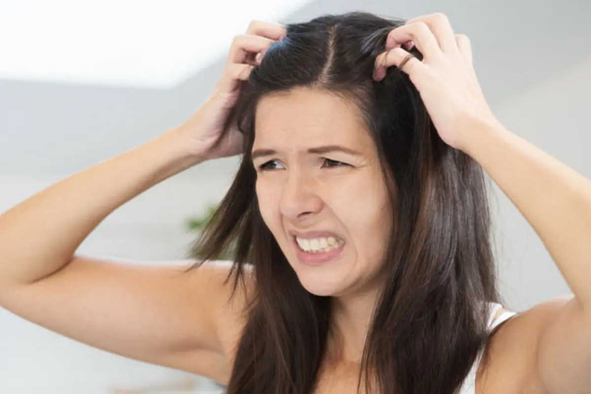 Trik Mudah Mengurangi Minyak pada Kulit Kepala dan Rambut