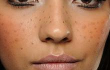 Cara Membuat Masker untuk Regenerasi Kulit Wajah, Solusi Alami untuk Mengatasi Flek Hitam pada Kulit
