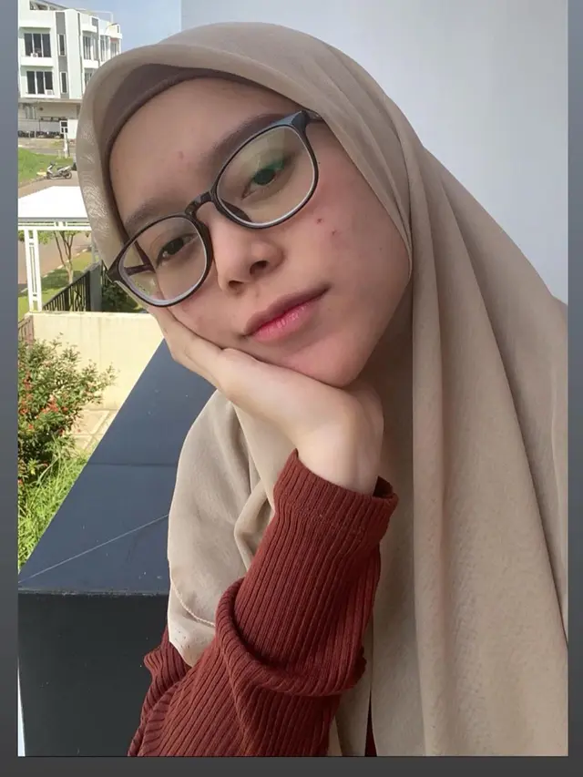 Disebut Berjerawat, Ini 6 Potret Lesty Kejora Tanpa Makeup