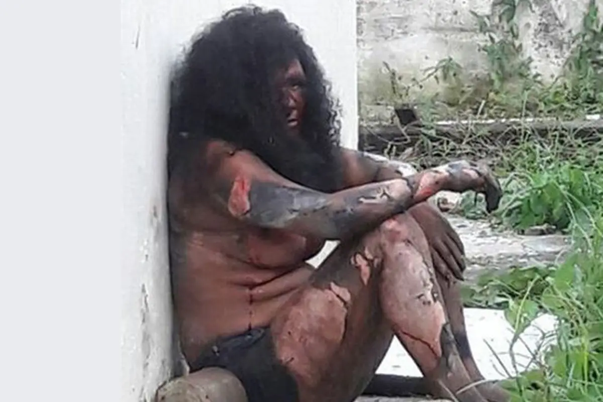 Horor, Diduga Penyebab Kebakaran,Gadis Dibakar Hidup-Hidup 