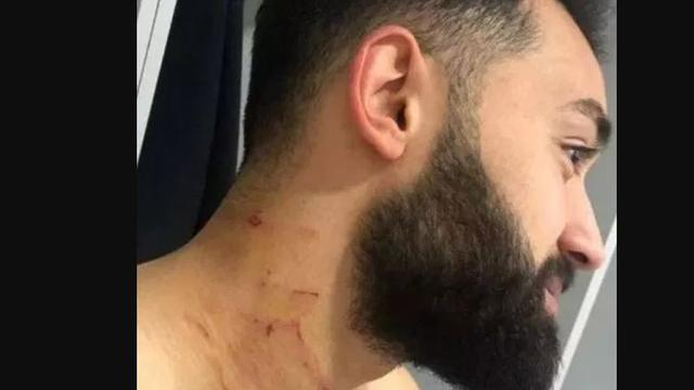 Pemain Turki, Ferhat Yazgan