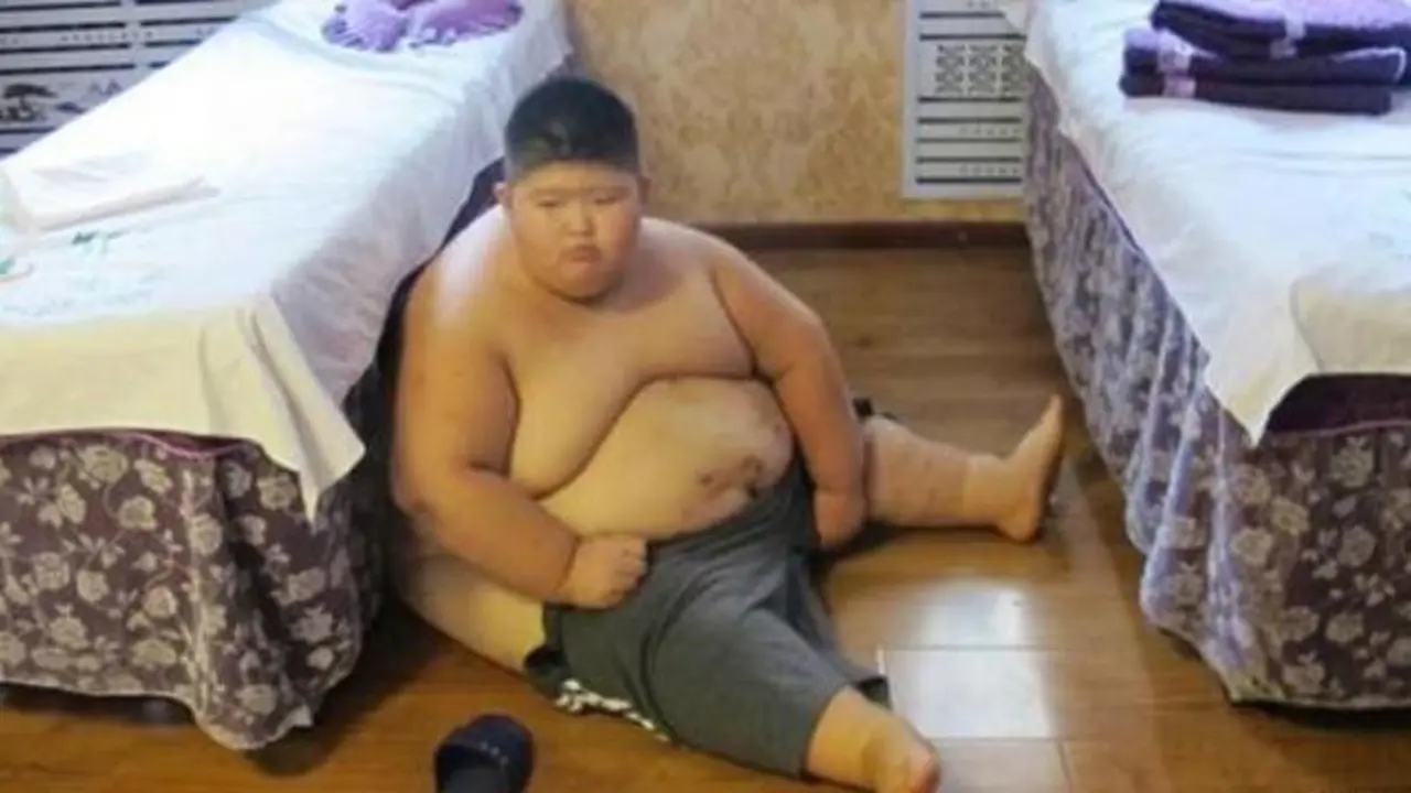 obesitas, berat badan berlebih, bocah obesitas
