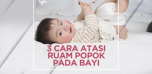 Cara Ampuh Mengatasi Ruam Popok pada Bayi