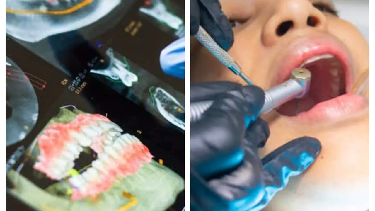 Lakukan 32 Prosedur Berlebihan dalam Satu Sesi, Wanita Ini Tuntut Dokter Giginya