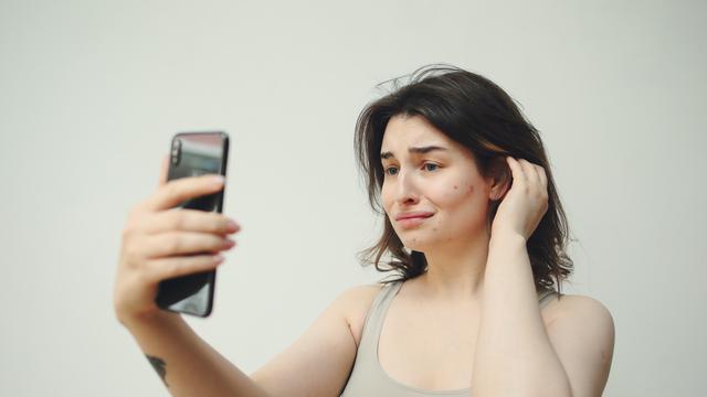 Mengapa Jerawat Masih Juga Muncul di Atas Usia 30 Tahun?