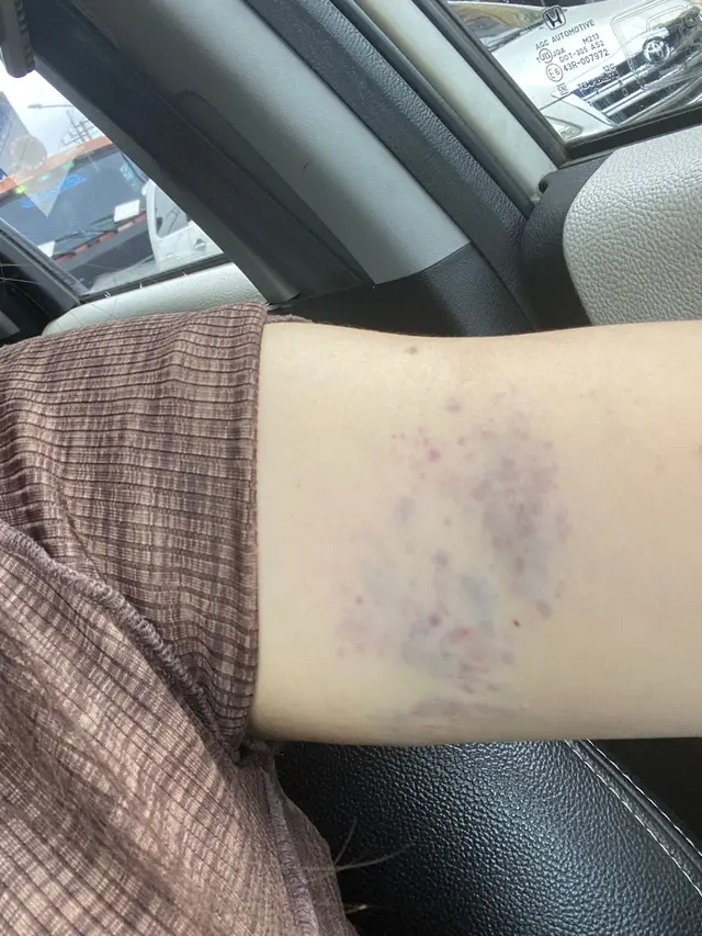 Sepupu Calon Istri Fritz Hutapea Jadi Korban KDRT