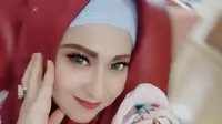 Pedangdut Wirdha Sylvina alias Neng Wirdha. (Istimewa)