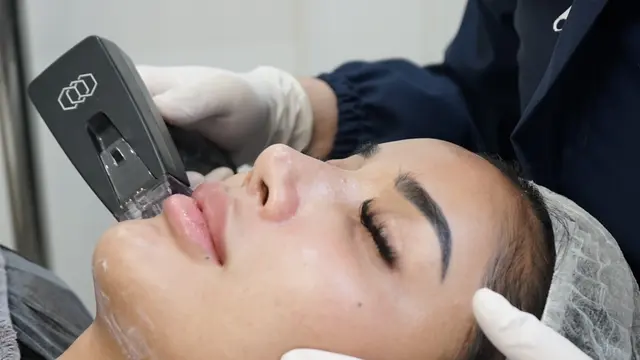 Millen Cyrus melakukan kombinasi treatment Level Up dan Mochi Morpheus